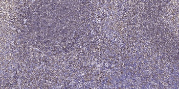 GABAA Rγ1 rabbit pAb
