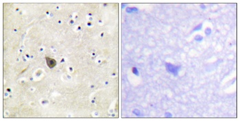PKD2 rabbit pAb Antibody