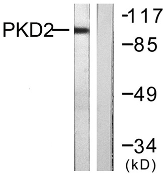 PKD2 rabbit pAb Antibody