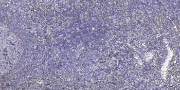 Puratrophin 1 rabbit pAb