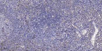 Puratrophin 1 antibody