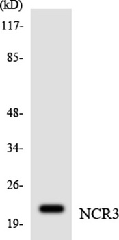 NKp30 antibody