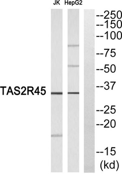 T2R45 rabbit pAb Antibody