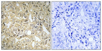 DHA Kinase rabbit pAb