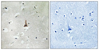 LRP10 rabbit pAb Antibody