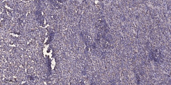 TIMAP antibody