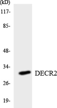 DECR2 rabbit pAb