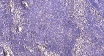 PRPF31 rabbit pAb