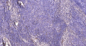 PRPF31 antibody