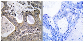 STEAP2 antibody