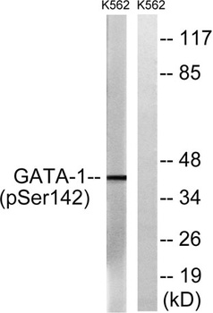 GATA-1 (phospho-Ser142) antibody
