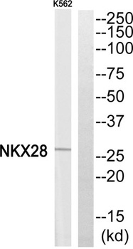 Nkx-2.8 rabbit pAb Antibody