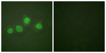 GATA-4 (phospho-Ser262) antibody