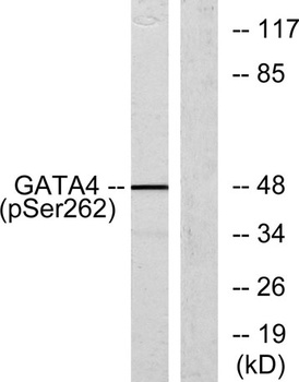 GATA-4 (phospho Ser262) rabbit pAb