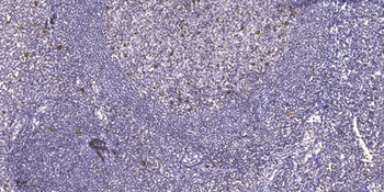 GATA-4 (phospho-Ser105) antibody
