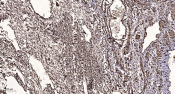 TIN2 antibody