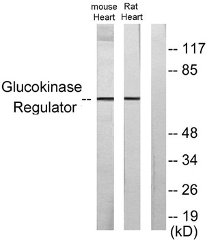 GCKR rabbit pAb Antibody