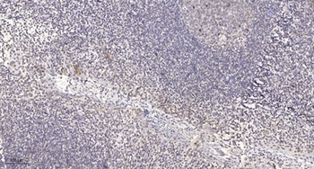 PHI-1 rabbit pAb Antibody