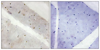 Kpm antibody