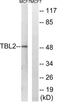 TBL2 rabbit pAb Antibody