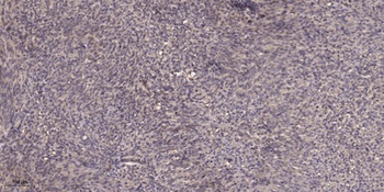 TBL2 rabbit pAb Antibody