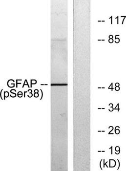 GFAP (phospho-Ser38) antibody [Out of stock]