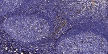 Somatotropin rabbit pAb Antibody