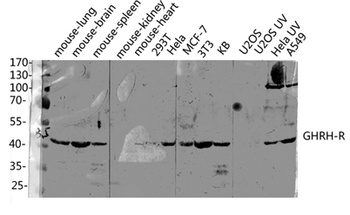 GHRH-R rabbit pAb