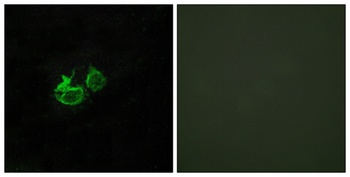 GHRH-R antibody