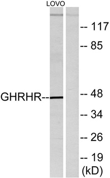 GHRH-R rabbit pAb