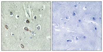 HBP1 (phospho Ser402) rabbit pAb