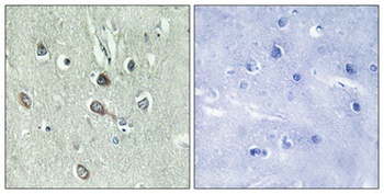 HBP1 (phospho-Ser402) antibody