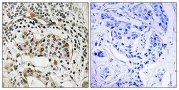 HBP1 (phospho-Ser402) antibody