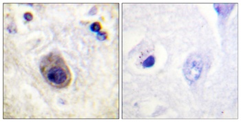 Connexin 43 (phospho Ser261) rabbit pAb