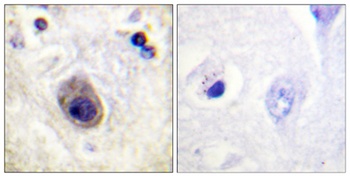 Connexin 43 (phospho-Ser261) antibody