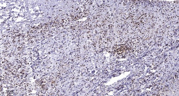 Mox1 antibody