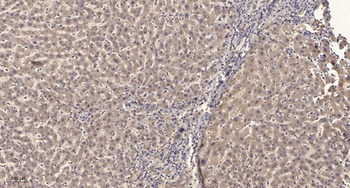 LAT (phospho Tyr200) rabbit pAb