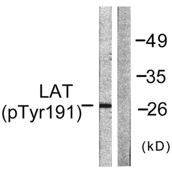 LAT (phospho Tyr191) rabbit pAb