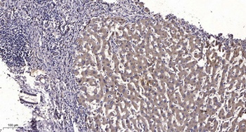 LAT antibody