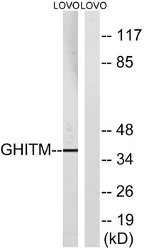 GHITM antibody