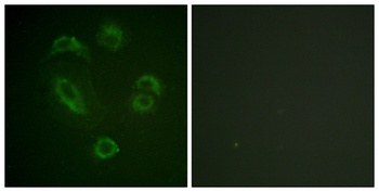 BAM32 (phospho-Tyr139) antibody