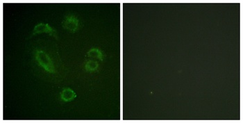 BAM32 (phospho Tyr139) rabbit pAb
