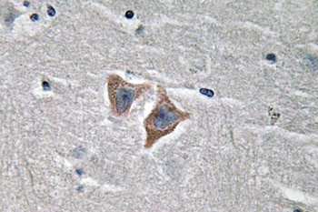 CD57 rabbit pAb