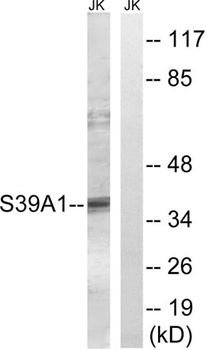 ZIP1 antibody