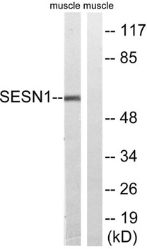 PA26 antibody
