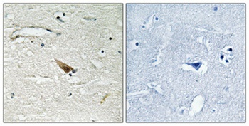 Pdcd-4 (phospho Ser67) rabbit pAb