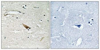 Pdcd-4 (phospho-Ser67) antibody