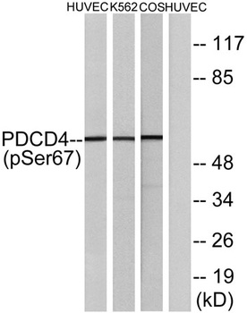 Pdcd-4 (phospho Ser67) rabbit pAb