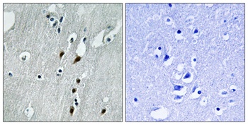 Pdcd-4 (phospho Ser457) rabbit pAb