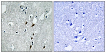 Pdcd-4 (phospho-Ser457) antibody